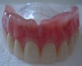 /album/estheticproteseodontologica/dentes-281-jpg/